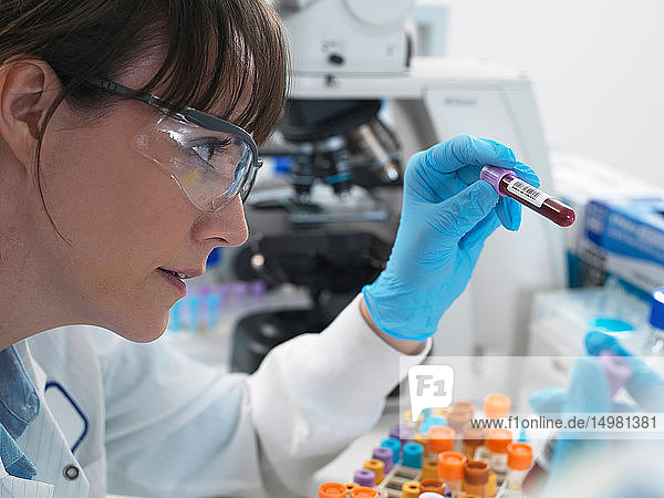 Weibliche Wissenschaftlerin untersucht Blutprobe  die im Labor getestet werden kann