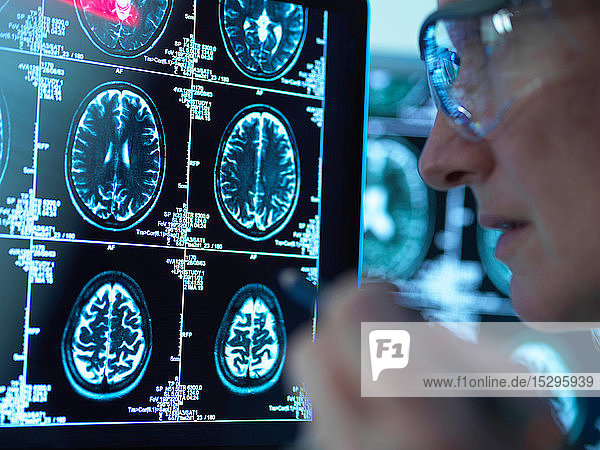 Arzt betrachtet Gehirnscans auf mögliche Krankheit oder Schäden in der Klinik
