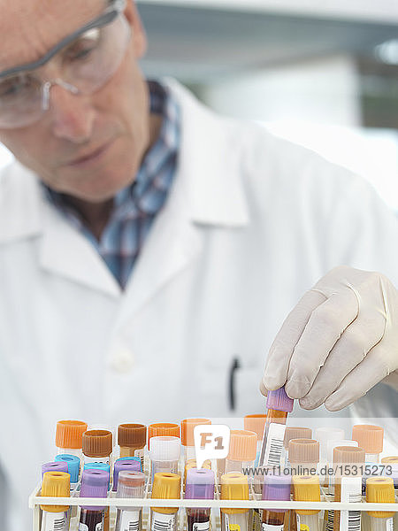 Medizintechniker kontrolliert Blutproben im Labor