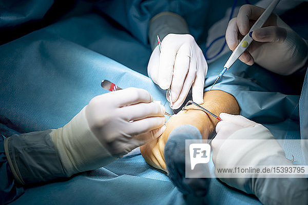 Ärzte  die eine Knöcheloperation im Krankenhaus durchführen