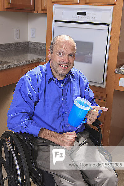 Mann mit Friedreich-Ataxie  der mit seinen deformierten Händen eine Tasse Wasser hält