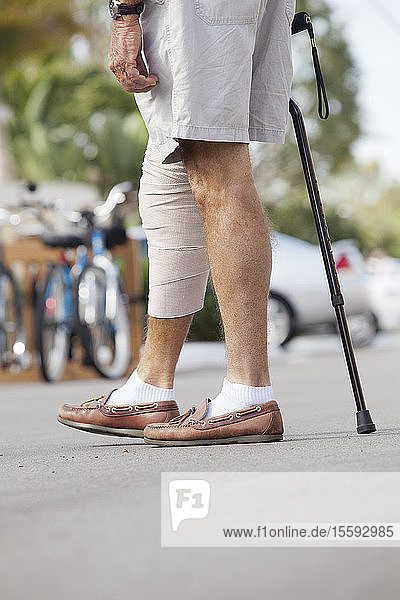 Älterer Mann mit Verband am Bein  der mit Hilfe eines Stocks geht