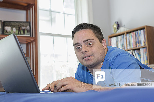 Man with Down Syndrome lying on bed using a laptop