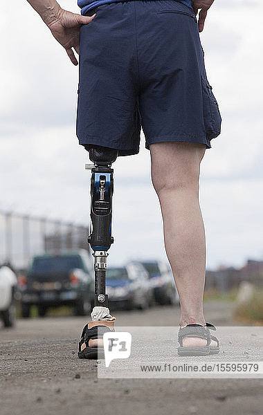 Woman with prosthetic leg standing on the road