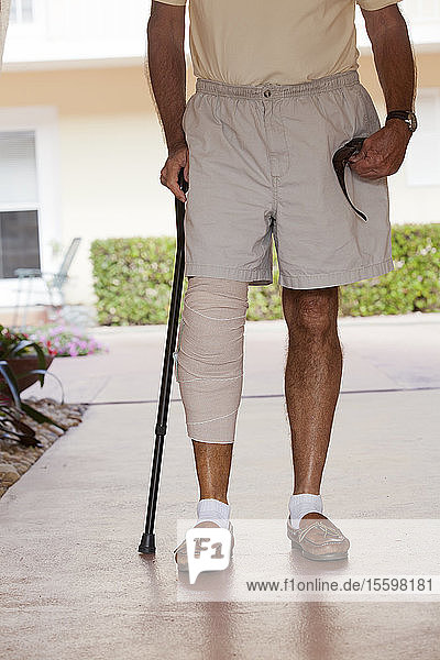 Älterer Mann mit Verband am Bein  der mit Hilfe eines Stocks steht