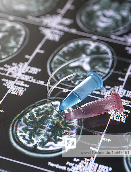 Klinische Proben aus einem Forschungsprojekt  die in Fläschchen mit Hirnscan-Bildern enthalten sind  Forschung über Alzheimer und demenzielle Erkrankungen.