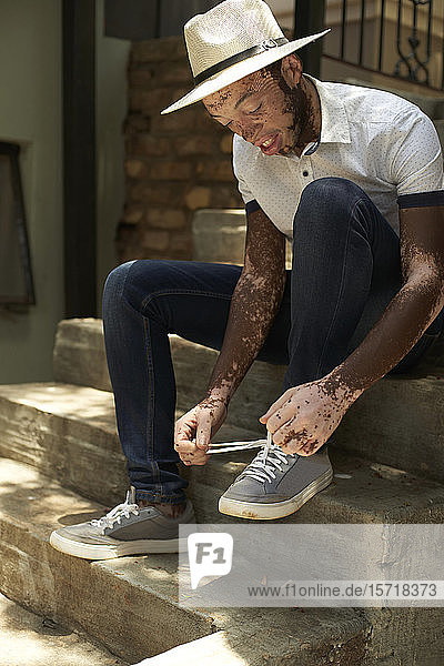 Porträt eines jungen Mannes mit Vitiligo  der einen Hut trägt  seine Schuhe zubindet und auf der Treppe sitzt