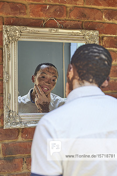 Young man with vitiligo looking in the mirror