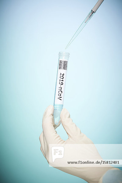Probe mit Coronavirus wird in Reagenzglas gefüllt