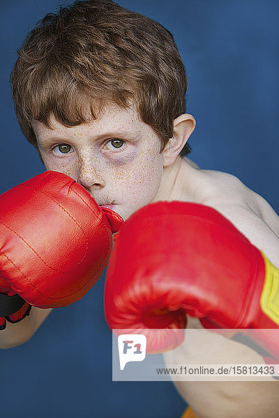 Porträt harter Junge mit blauem Auge und Boxhandschuhen in Kampfhaltung