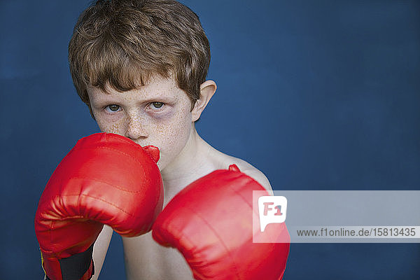 Porträt harter Junge mit blauem Auge und Boxhandschuhen in Kampfstellung