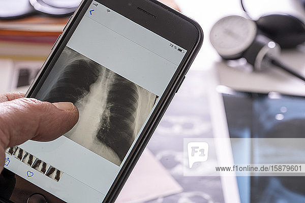 Person's hand checking x ray on smartphone