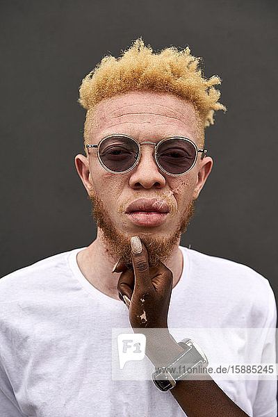 Porträt eines Albino-Mannes  der von Frauenhand berührt wird