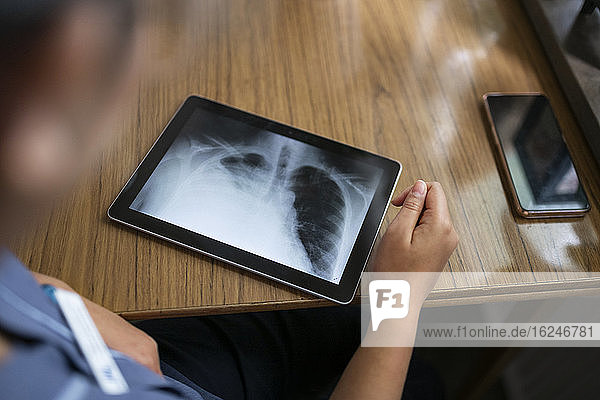 Digital tablet showing X-ray