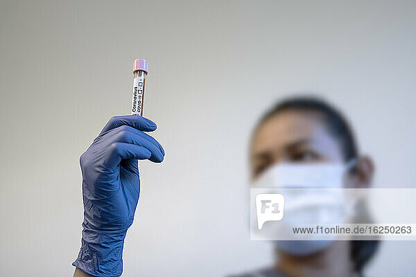 Die Krankenschwester hält ein Reagenzglas mit Blut