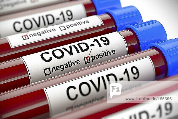 3D-Darstellung  Blutprobenröhrchen mit positivem COVID-19-Test