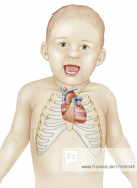 Lage des Herzens im Brustkorb eines Säuglings  Pädiatrie. Das Herz befindet sich nicht in der Mitte des Brustkorbs. Es ist vielmehr nach links verschoben. Das Herz eines Säuglings ist horizontaler positioniert als bei einem Kind oder Erwachsenen. Sein Scheitelpunkt befindet sich also auf der Höhe des 4. linken Interkostalraums. Diese Position behält er bis zum 4. Lebensjahr bei. Zwischen dem 4. und 6. Lebensjahr verschiebt sich das Herz allmählich  so dass sich der Apex auf der Höhe des 5. Im Alter von 7 Jahren befindet sich das Herz daher auf der gleichen Achse wie das eines Erwachsenen.