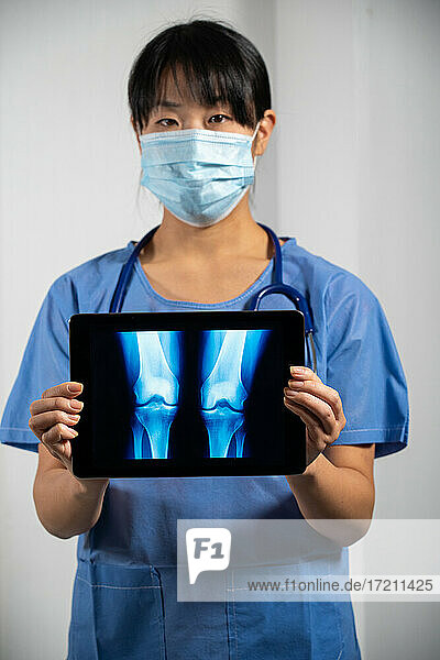 Female doctor holding a screen with x-ray of lungs.