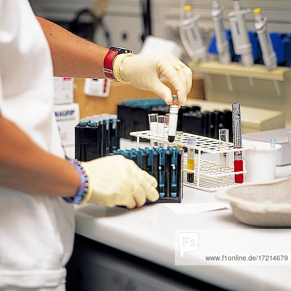 Medicine  biology  analysis  blood analysis  urine sample  control  health | Medicine  biology  analysis  blood analysis  urine sample  control  health