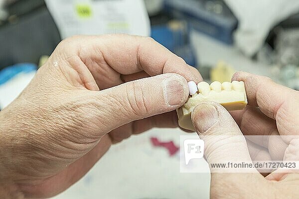 Männlicher Zahntechniker bei der Arbeit an einer 3D-gedruckten Form für Zahnimplantate im Labor