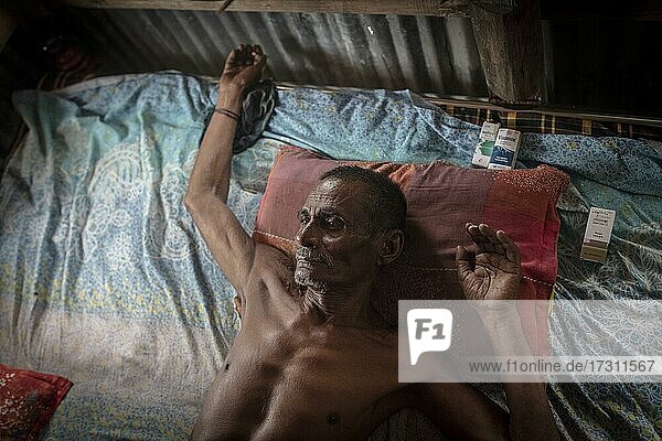 Mann auf seinem Bett in seiner Hütte  neben dem Kissen liegen seine Medikamente  er ist fast blind und kann nur schwer atmen  da er sein Leben lang salzhaltiges und arsenverseuchtes Trinkwasser zu sich genommen hat  Mongla  Sundarbans  Bangladesch  Asien