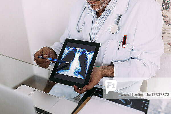 Senior male doctor explaining x-ray on digital tablet in hospital