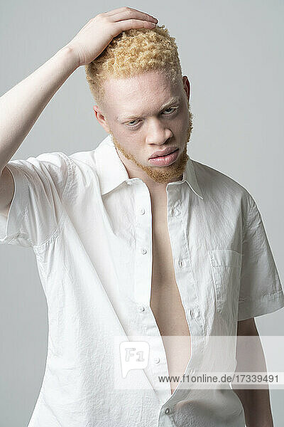 Studio-Porträt eines Albino-Mannes im weißen Hemd