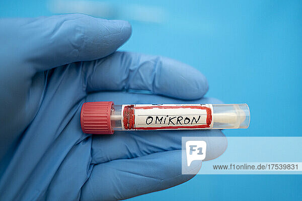 Doctor wearing protective glove holding Omicron sample swab tube with against blue background