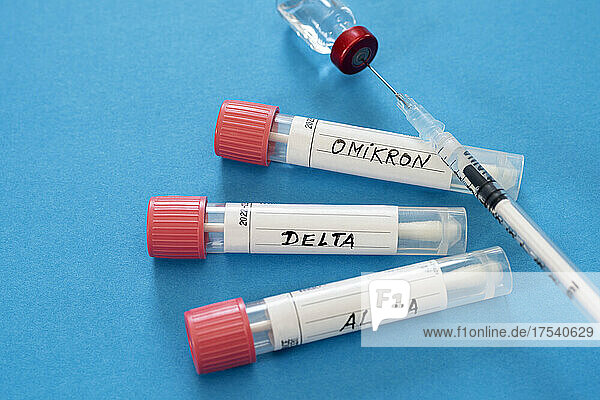 Injection and swab tubes with medical samples against blue background