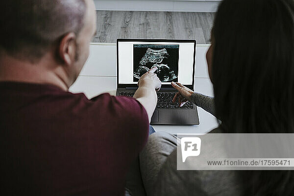 Man and woman watching ultrasound on laptop at home