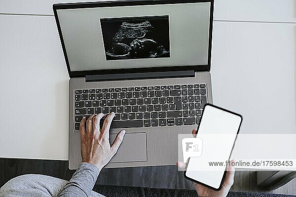 Woman holding smart phone with ultrasound on laptop at home
