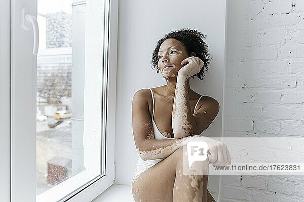 Woman with vitiligo looking through glass window at home