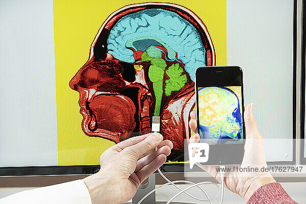 Close-up of hands holding a smartphone and connecting it to a brain image on a computer screen.