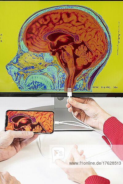 Close-up of hands showing how to connect a smartphone to a brain depicted in a medical image.