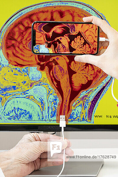 Close-up of hands showing how to connect a smartphone to a brain depicted in a medical image.