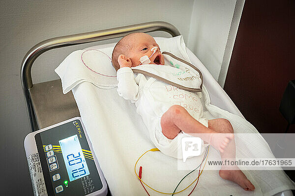 Weighing of a newborn born prematurely on a scale in a hospital center.