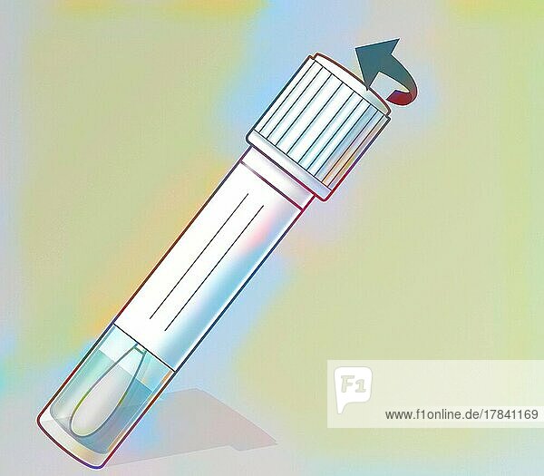 Vaginal self-sampling: the wet swab is given to the doctor for analysis.