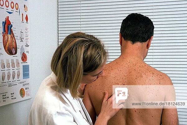 Mann beim Hautarzt  Dermatologe  Dermatologin  untersucht Haut  Hautveraenderungen auf Rücken  Hautkrebs  Hautkrebsvorsorge  Hautkrebsvorsorgeuntersuchung  Krebs  Muttermal  Leberfleck  Hautflecken