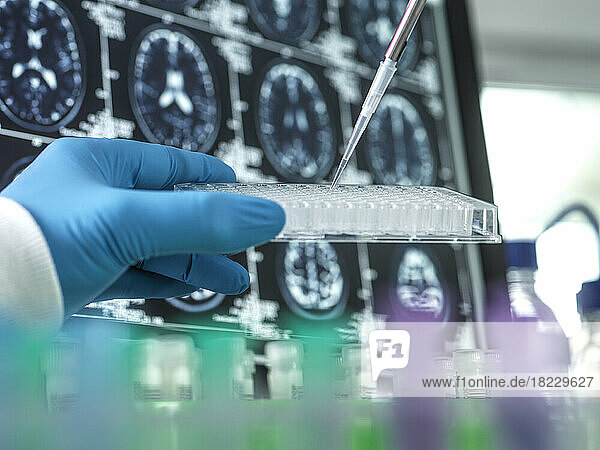 Close-up?of gloved hand holding pipette and test tubs in front of brain scans