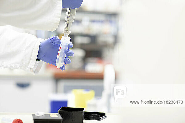 Hands of scientist filling plastic tube with medical sample at laboratory