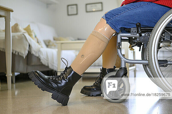 Close up of orthopedic legs of a woman sitting in a wheelchair.