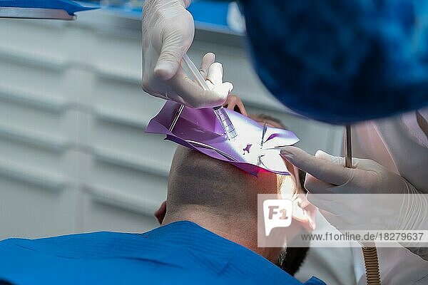 Zahnklinik  Detail eines Arztes  der eine endodontische Behandlung an einem Patienten in voller Aktion durchführt