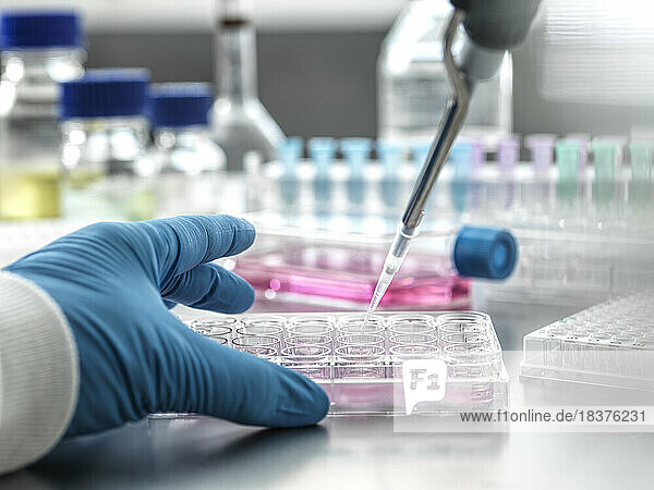 Scientist pipetting medical samples into microplate in laboratory