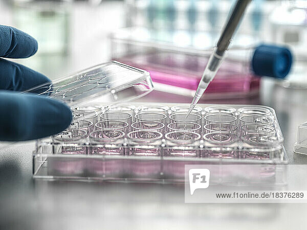 Scientist pipetting medical samples into microplate in laboratory