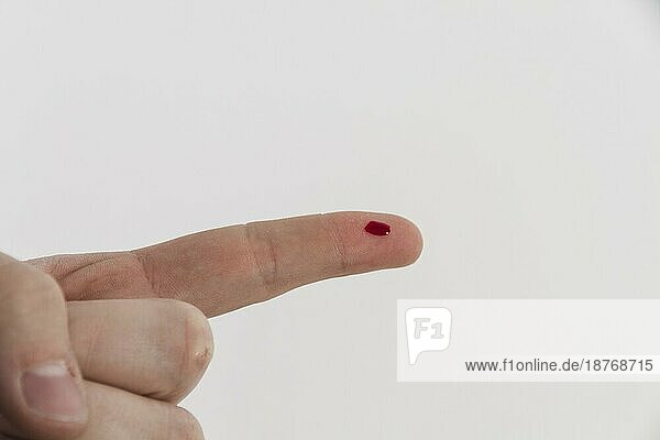 Blutender Finger