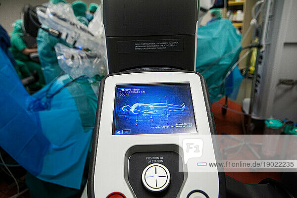 Control screen of a robot surgeon  during a hysterectomy in the operating room.