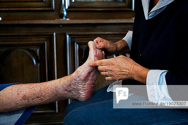 Liberal nurse visiting an elderly person. Care of legs and small wounds.