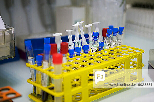 Analysis laboratory in a hospital  sample tubes.