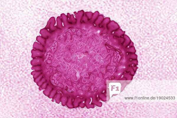 Influenza virus of the Orthomyxoviridae family (respiratory viral infection). Transmission electron microscopy  viral diameter 80 to 120 nanometers.