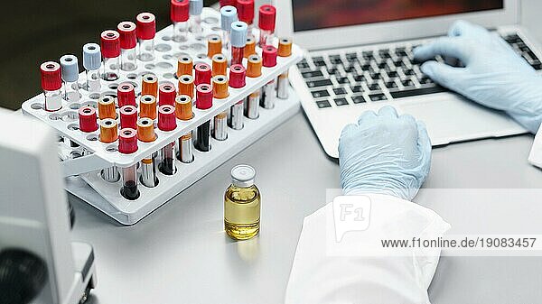 Weibliche Forscherin Labor mit Impfstoff Flasche Reagenzgläser